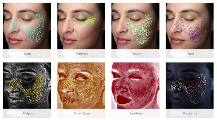 1688899783695357.webp skin analyzer detail Application.webp